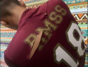 Warga Perumahan Aurduri Jadi Korban Pembacokan