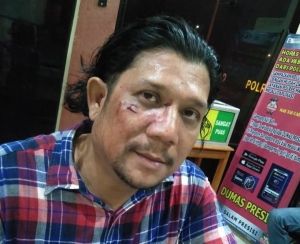 SMSI Pusat Desak Polisi Usut Kasus Penganiayaan Ketua SMSI Madina Terkait Pemberitaan