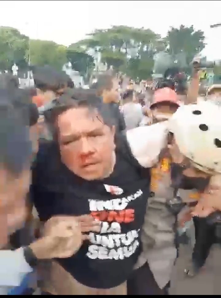 Wajah Lebam Ade Armando di Pukul oleh Massa Demo.