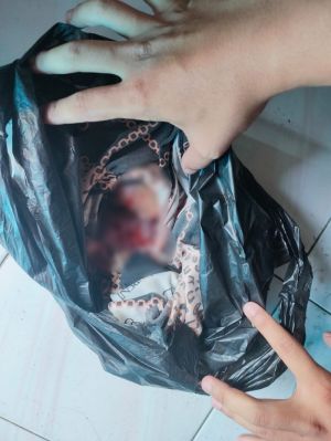 Ibu Muda Ditangkap Lantaran Gugurkan Kandungan Hasil Hubungan Gelap