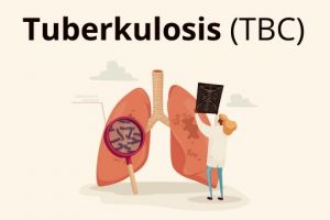 TBC Renggut 163 Nyawa Penderitanya di Kota Jambi